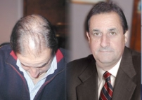 Cirugía Estética del Cabello